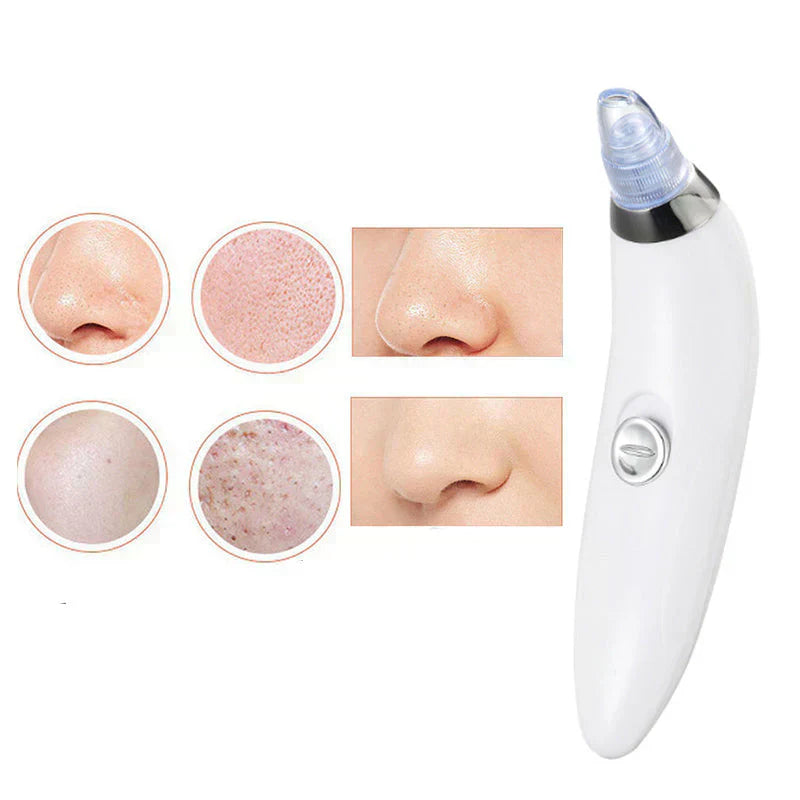 Hanif Traders™ 4 in 1 Derma Blackhead Remover Machine